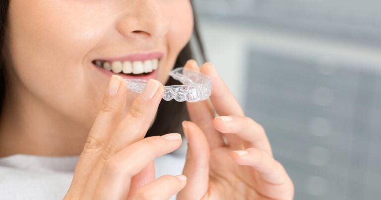 Getting Invisalign in Las Vegas: What to Expect and How to Get Started?