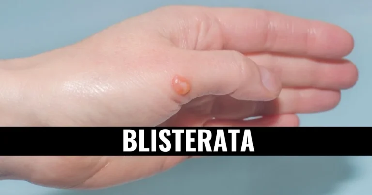 Unveiling the Enigma of Blisterata: A Dive into Nature's Peculiar Phenomenon
